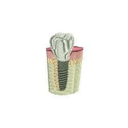 Embroidery Design Tooth Implant